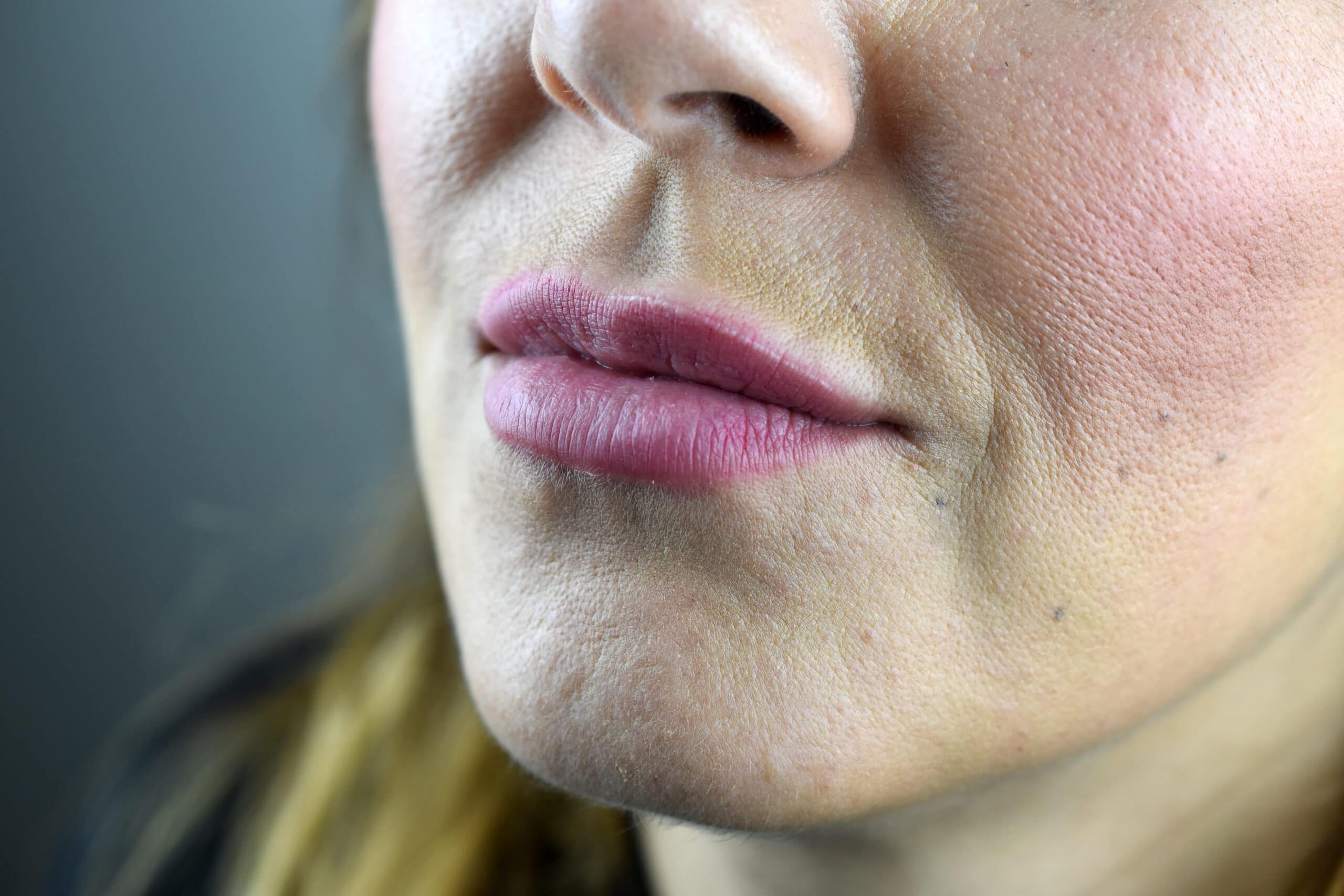 Ergebnis nach einem Jahr Secret Lips
